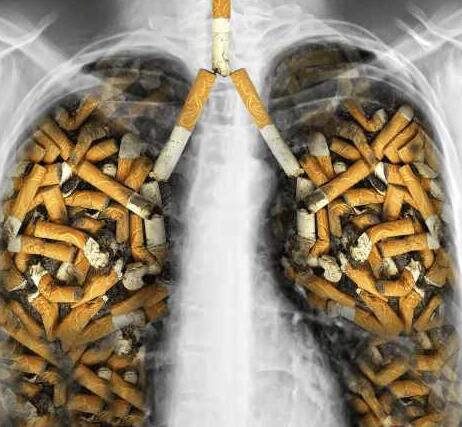 长期吸烟者的黑肺 戒烟后能恢复正常人水平吗